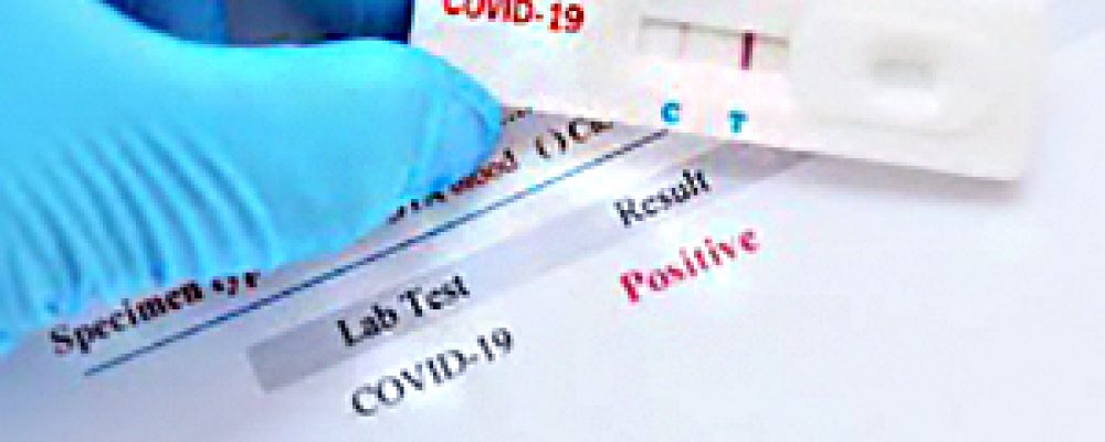 Posibilidad de hacer test rápidos