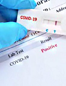 Posibilidad de hacer test rápidos